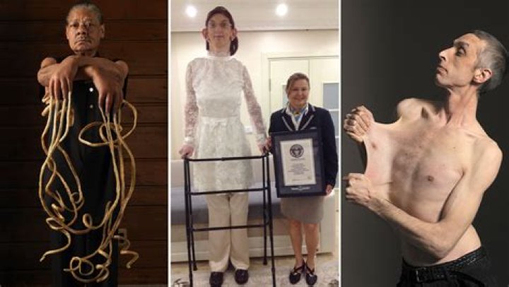 The Ultimate Guide to the World's Skinniest Human