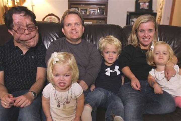 Understanding Adam Pearson's Wife: A Deep Dive into Their Relationship