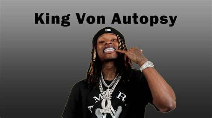 Unraveling the Mystery Behind King Von's Autopsy Photo