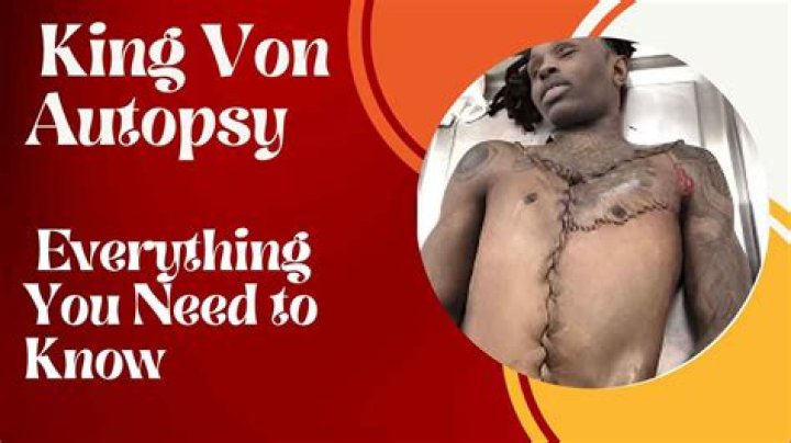 Unraveling the Truth: King Von Autopsy Cause of Death